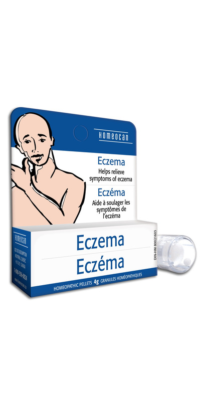 Homeopatic releive for eczema